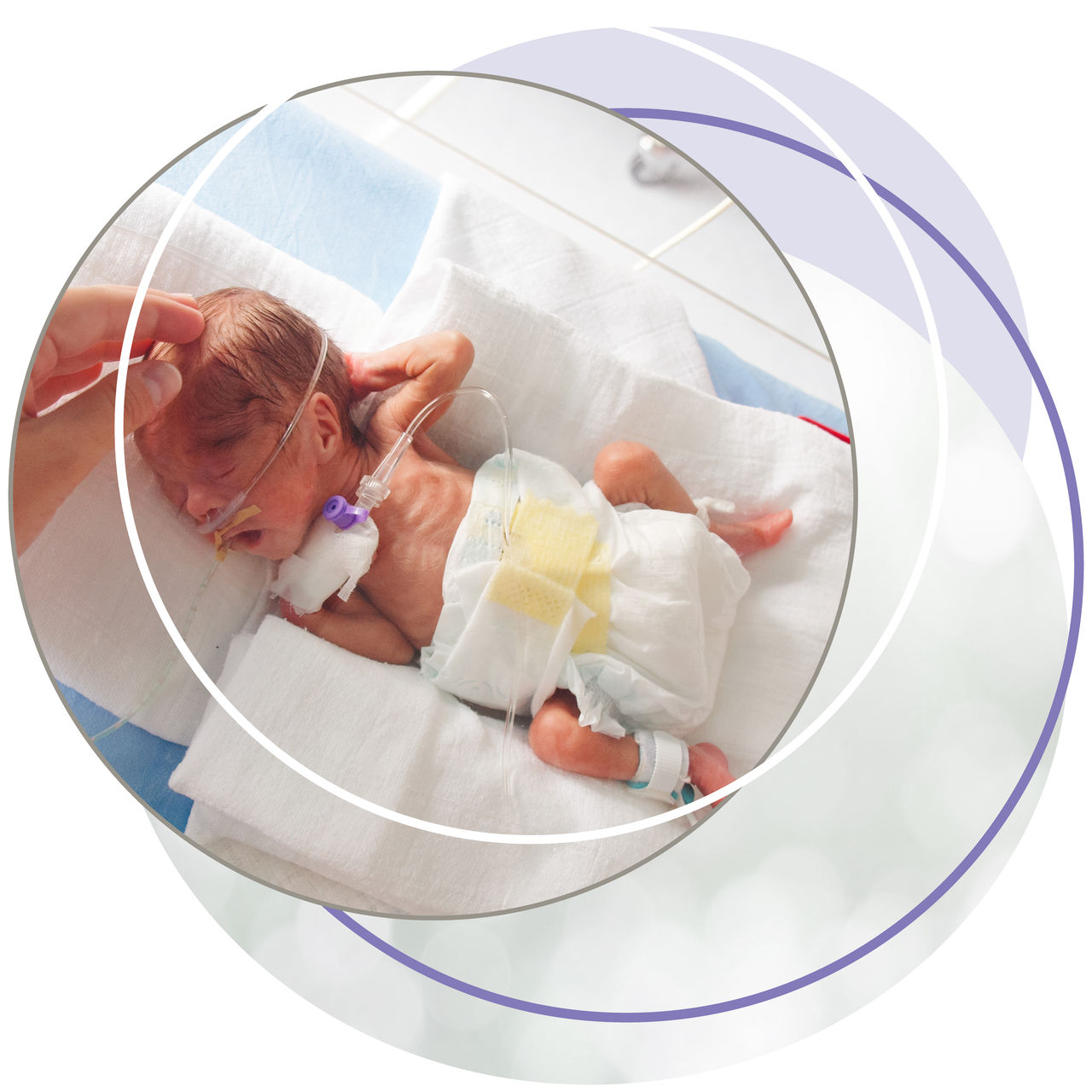 Premature newborn in hospital neonatal care unit