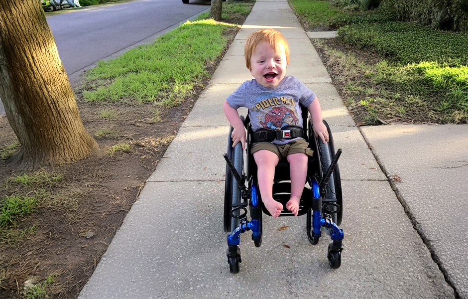 MJ a child with Osteogenesis Imperfecta